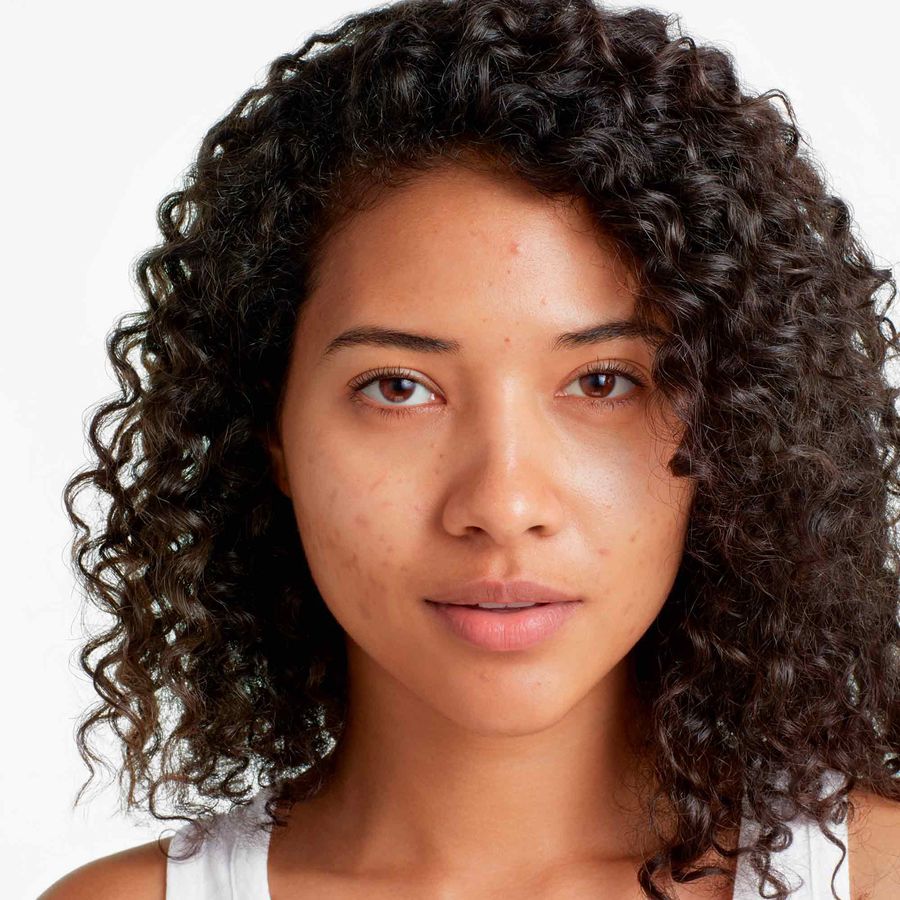 Clinique Base Liquida Anti-Blemish Fresh 30ml