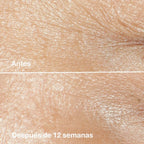 Crema Antiarrugas Clinique Smart Clinical Repair 50ml
