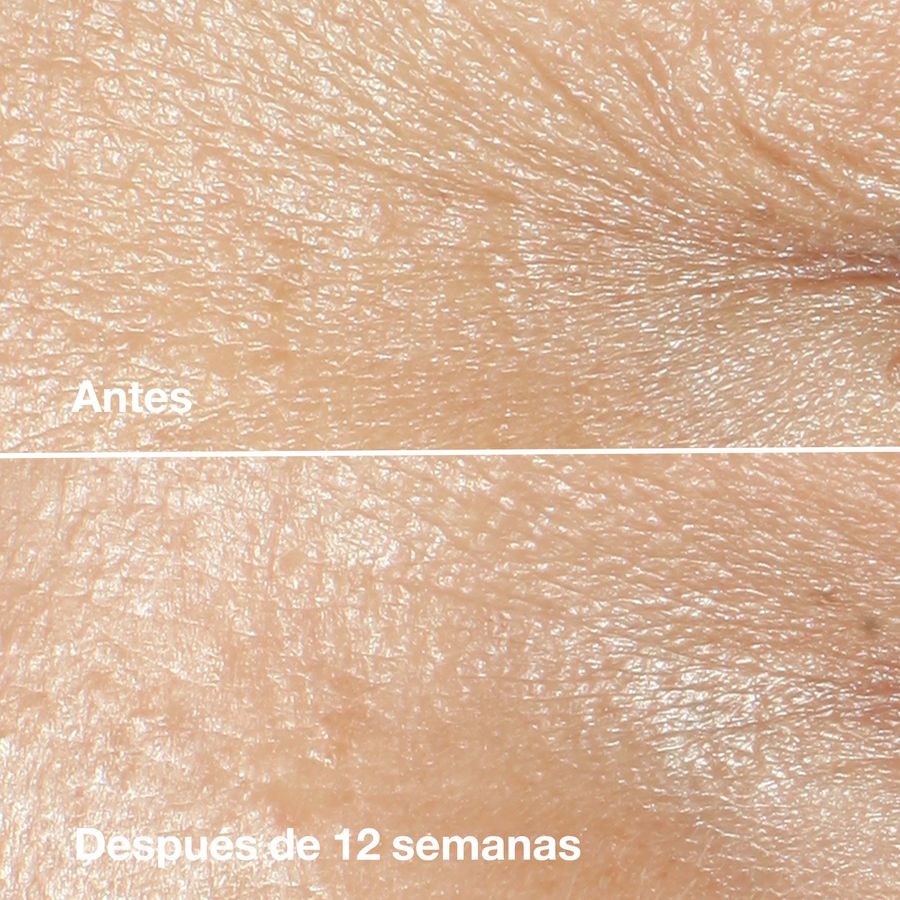 Crema Antiarrugas Clinique Smart Clinical Repair 50ml