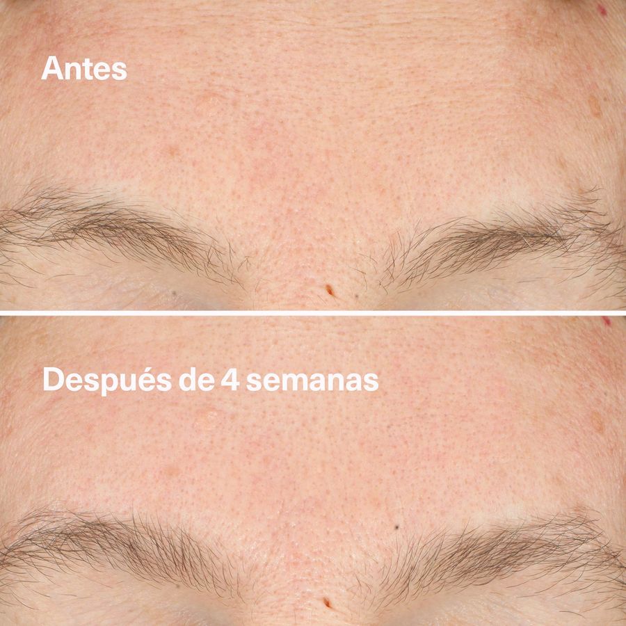 Clinique Locion Clarificante Do-Over Peel 30ml