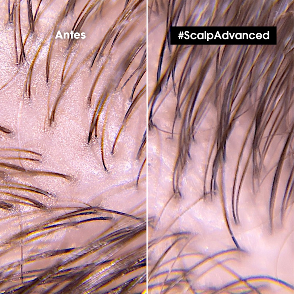 Shampoo en gel que purifica el cuero cabelludo y la fibra de residuos, sudor y grasa para una sensación más fresca y limpia Scalp Advanced Anti-Oiliness 500 ml Loreal Professionnel