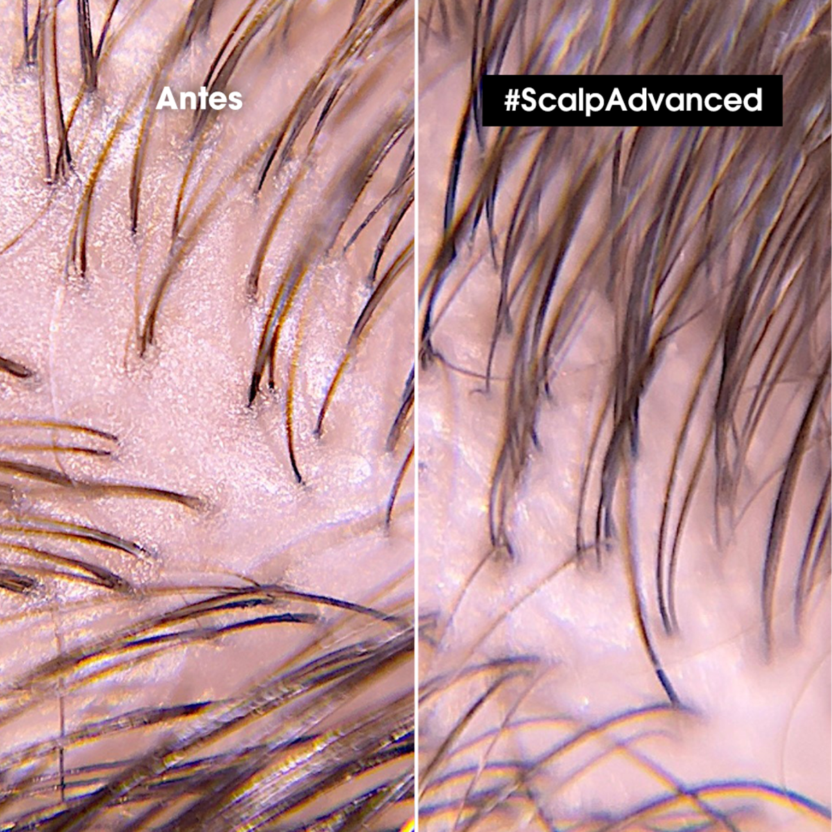 Shampoo en gel que purifica el cuero cabelludo y la fibra de residuos, sudor y grasa para una sensación más fresca y limpia Scalp Advanced Anti-Oiliness 500 ml Loreal Professionnel