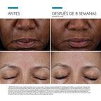 SkinCeuticals Sérum Exfoliante Antiedad Cell Cycle Catalyst 30ml