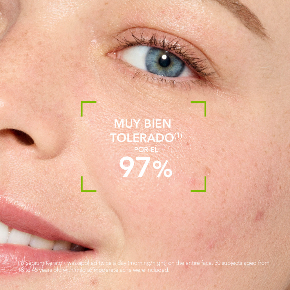 Sebium Kerato+ Gel Crema Anti-imperfecciones 30ml