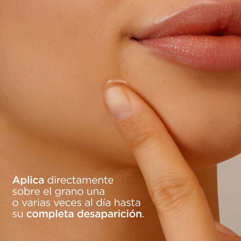 Isdin Acniben ON THE SPOT 15ml - Gel corrector de granos faciales localizados para piel el mixta a grasa
