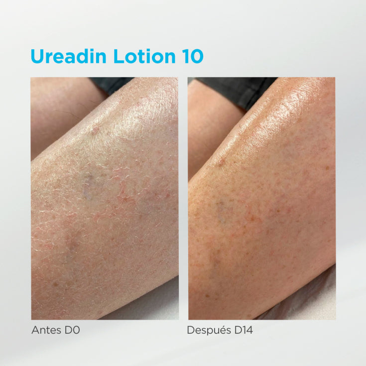 Isdin Ureadin Lotion10 Hidratación Intensa