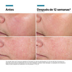 SkinCeuticals Crema Regeneradora Advanced RGN-6 50ml